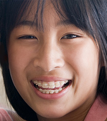 Girl with clear braces